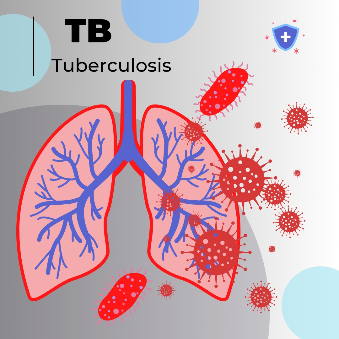 Introducing Impact of Tuberculosis (TB): Second Only to COVID-19